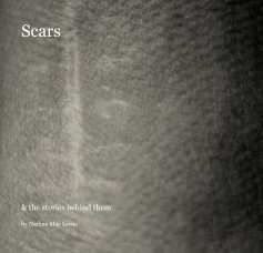 Scars book cover