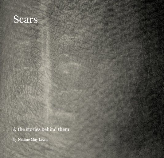 View Scars by Nadine May Lewis
