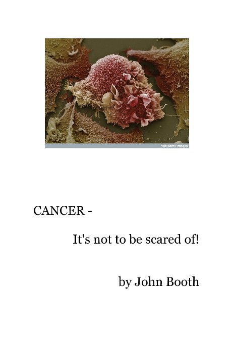 View CANCER - It's not to be scared of! by John Booth