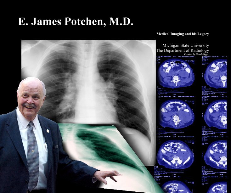 Ver E. James Potchen, M.D. por Michigan State University The Department of Radiology Created by Gearl Diggs