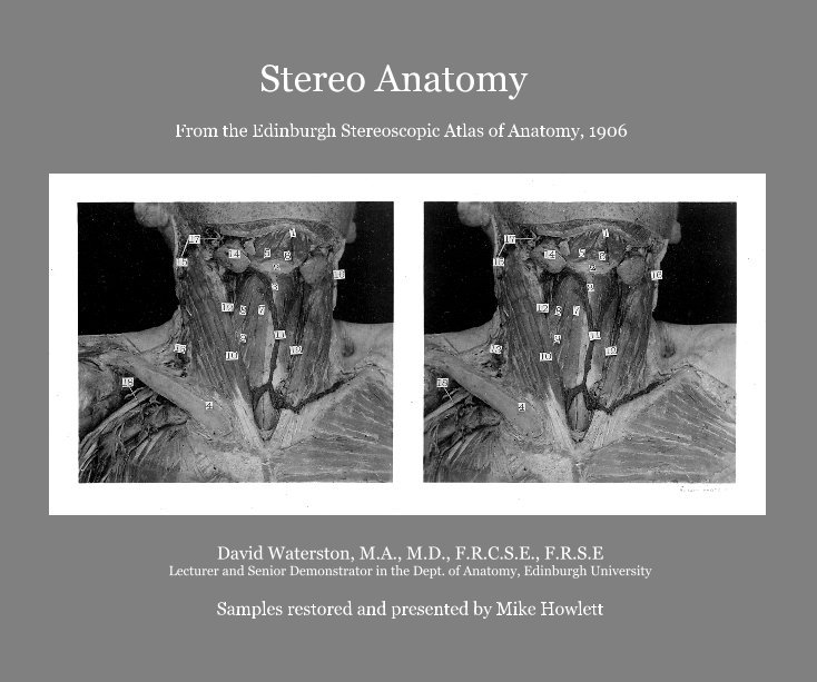 View Stereo Anatomy by David Waterston, Edinburgh Uni
