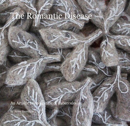 View The Romantic Disease by Anna Dumitriu