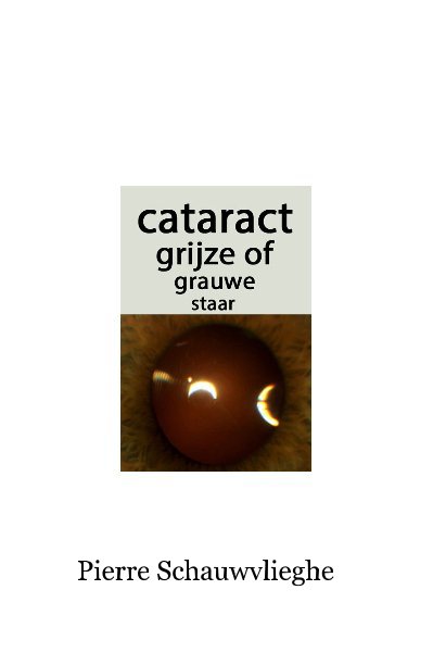 Visualizza Cataract of staar di Pierre Schauwvlieghe