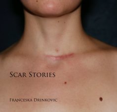 Scar Stories book cover