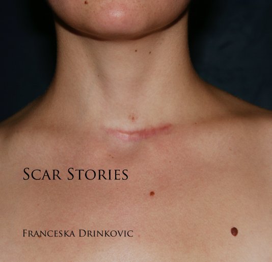 View Scar Stories by Franceska Drinkovic
