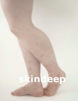 skindeep book cover