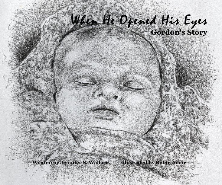 View When He Opened His Eyes Gordon's Story Written by Jennifer S. Wallace Illustrated by Robin Adair by Jennifer S. Wallace