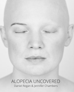 Alopecia Uncovered (softback) book cover