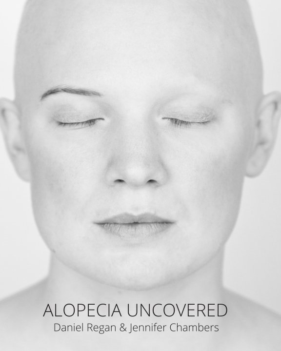 View Alopecia Uncovered (softback) by Daniel Regan & Jennifer Chambers
