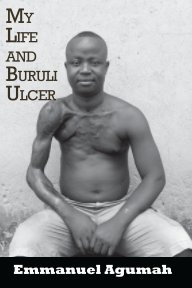 My Life and Buruli Ulcer book cover